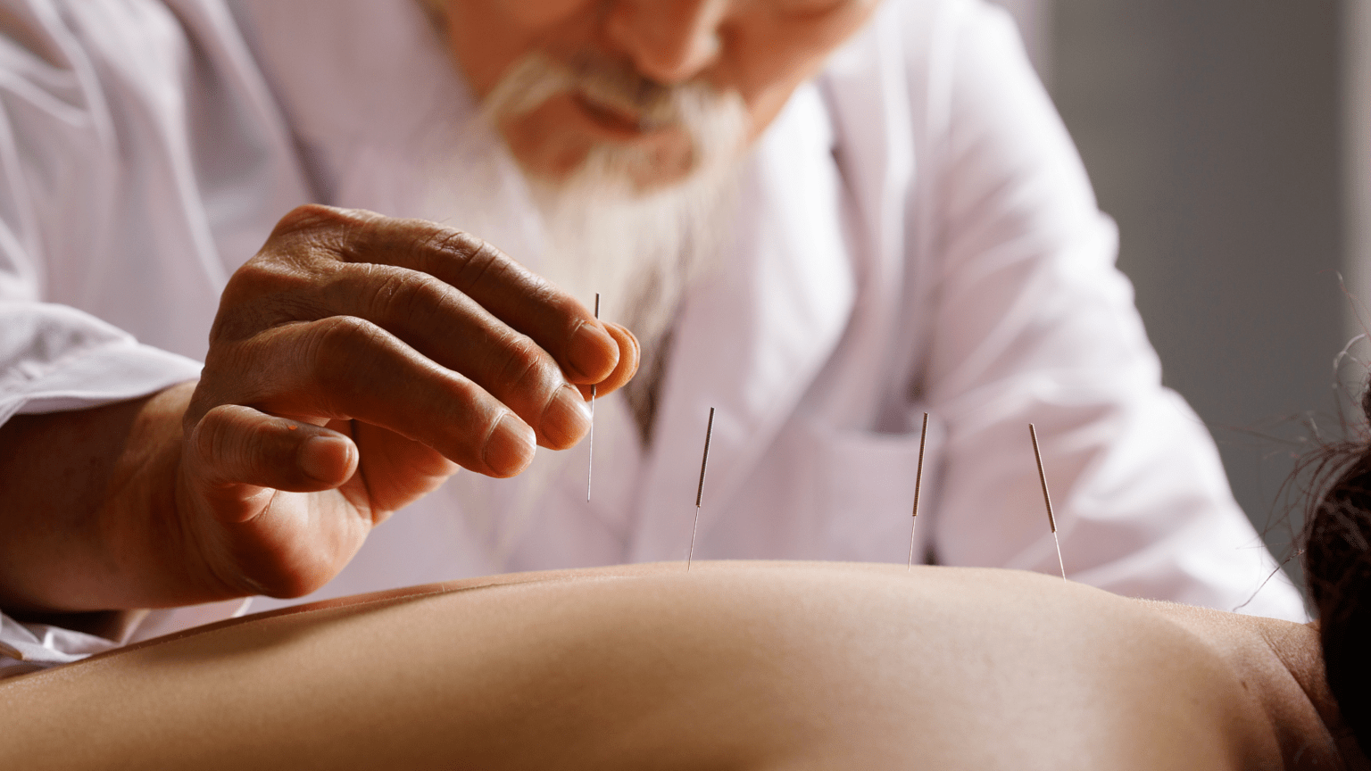 中医 Acupuncture